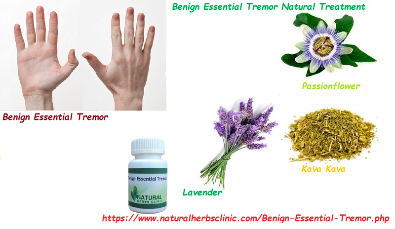 Illustration for article titled Benign
Essential Tremor Natural Treatment